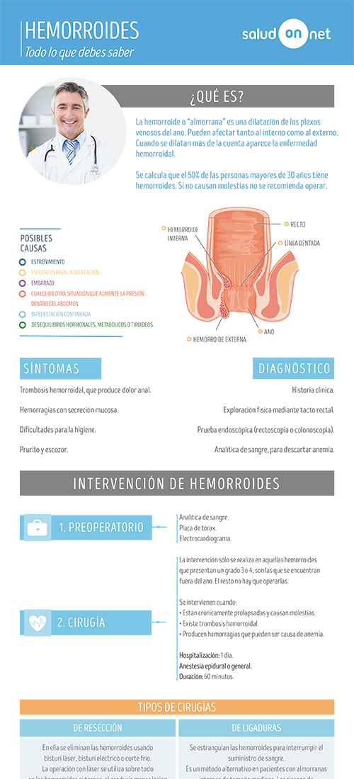 Infografía Hemorroides