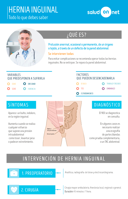 Infografía Hernia Inguinal