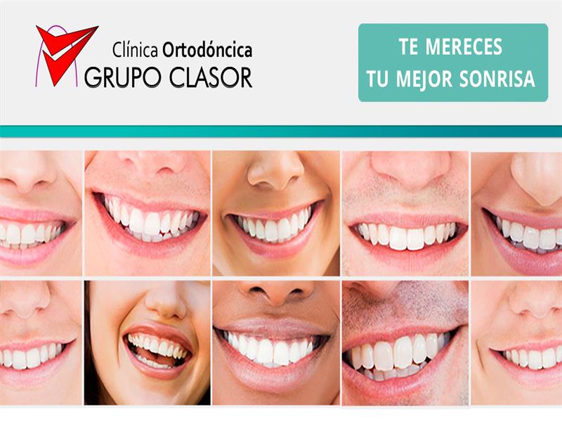 Clínica de Ortodoncia Madrid - Grupo Clasor