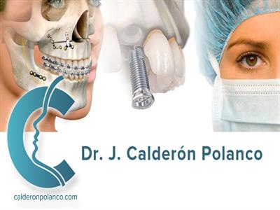 Javier Calderón Polanco