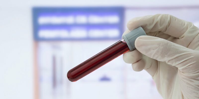 Asociación tabaco pasos Qué es el HCM en los análisis de sangre - Blog SaludOnNet