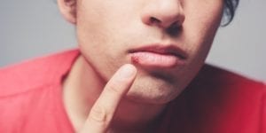 Cómo curar el herpes labial o calentura