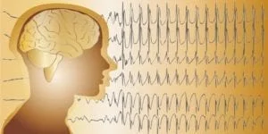 Epilepsia: en qué consiste este trastorno y cómo se trata