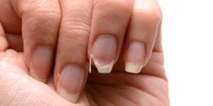 ¿Por qué se rompen las uñas?