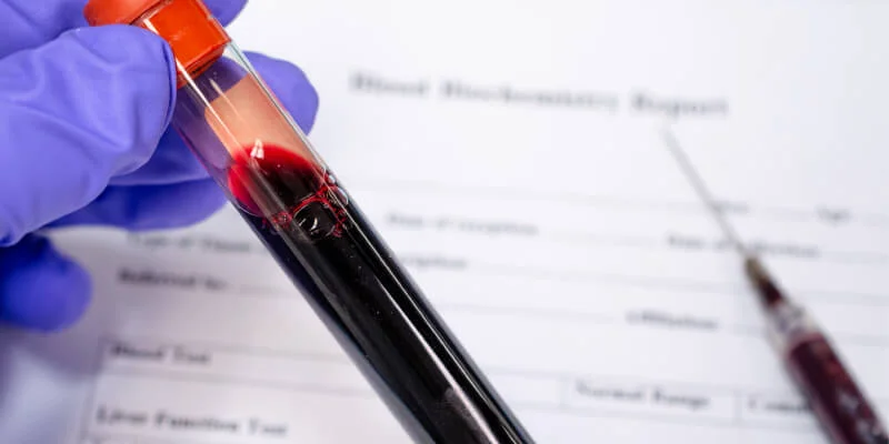 Qué significa y causas del RDW alto o bajo en una analítica de sangre - Blog SaludOnNet