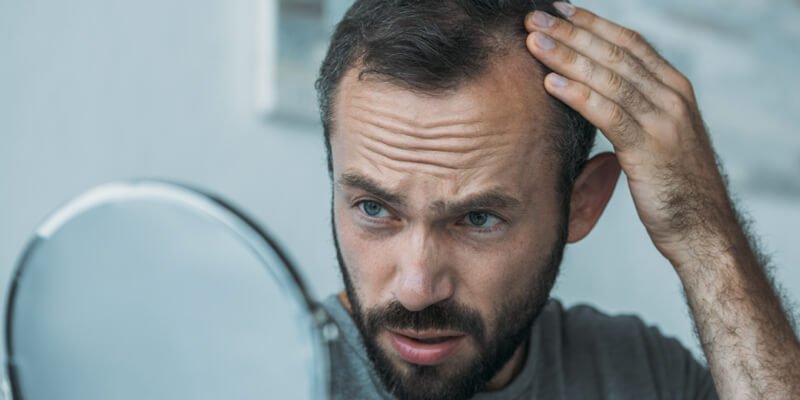 Soluciones efectivas para la pérdida de pelo o alopecia