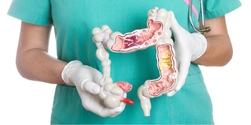 maqueta de intestino