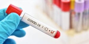 ¿Cómo sé si he generado anticuerpos del Covid-19?