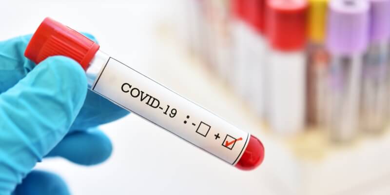 Diferencias entre los tests de la Covid-19