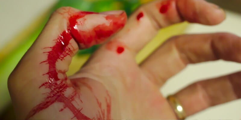 ¿Qué tipos de heridas hay y cómo se curan?