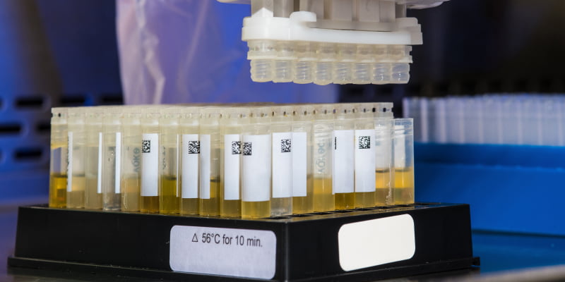 muestras de orina en laboratorio