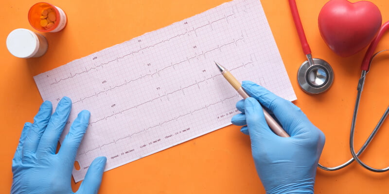 electrocardiograma con fibrilación