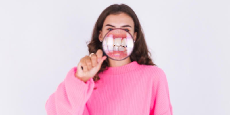 Prevención de las manchas dentales: causas y soluciones